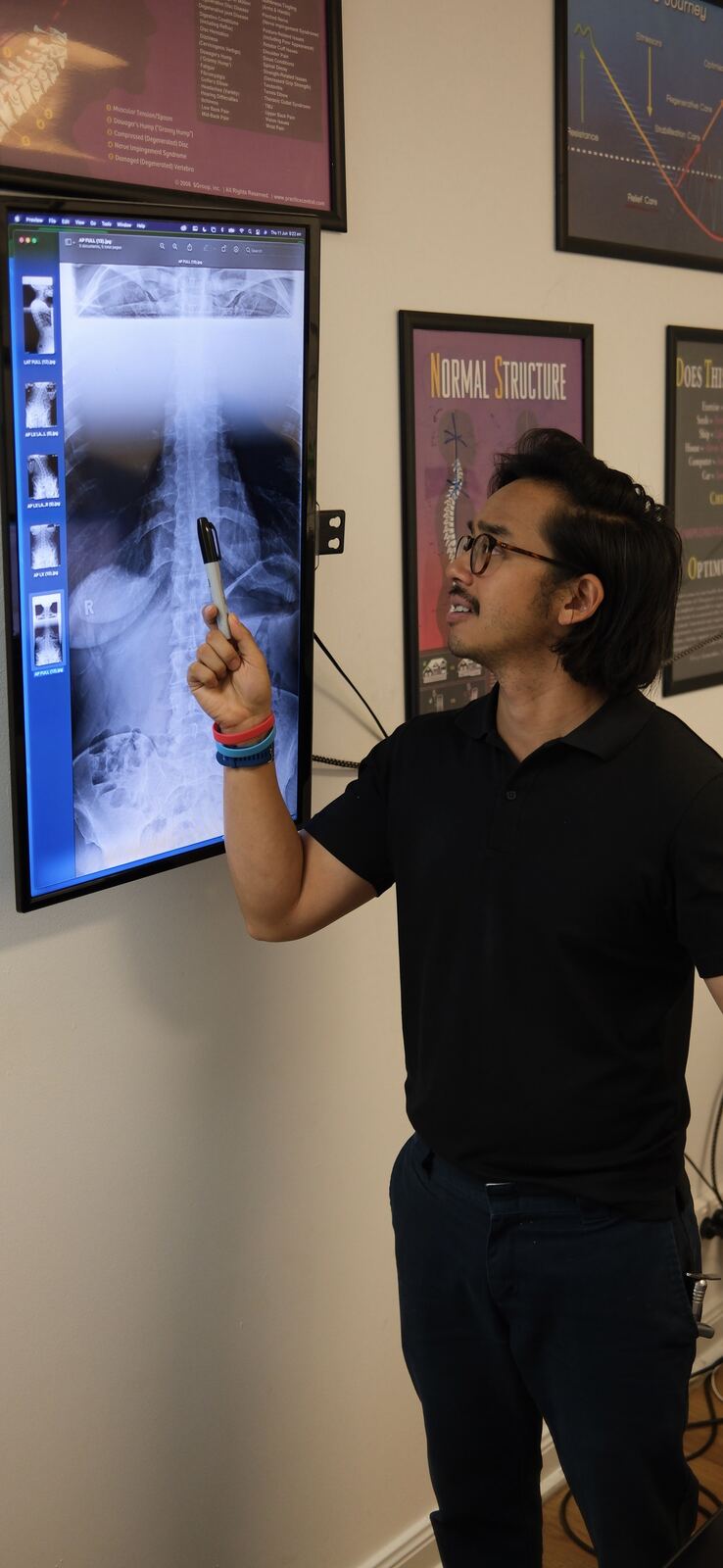 Dr Dominic Phung explaining a spinal X-ray to a patient